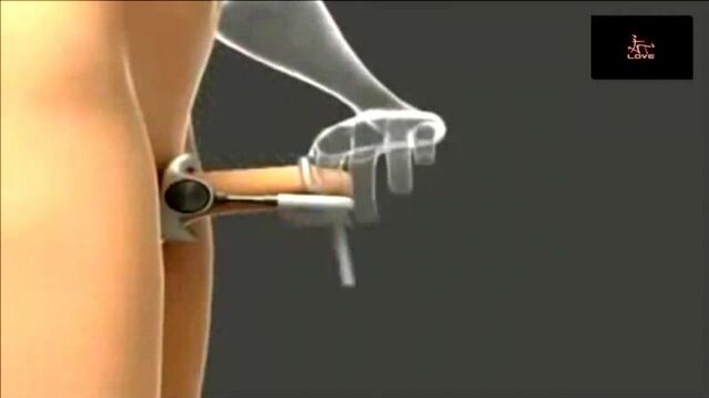 ProExtender для увеличения члена (секс-игрушки, sex-toys, орал, Blowjob, минет, пенис, член, эротика, вагина, киска, pussy)