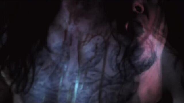 SUTURE - Carcinoma Contagion