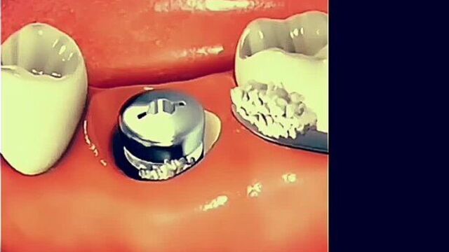 Video by Стоматология Медента Магнитогорск • Сибай