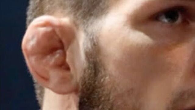 Парни ломают уши, чтобы походить на Хабиба